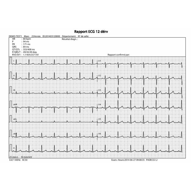 Edan PADECG Digital ECG Android Android or IOS